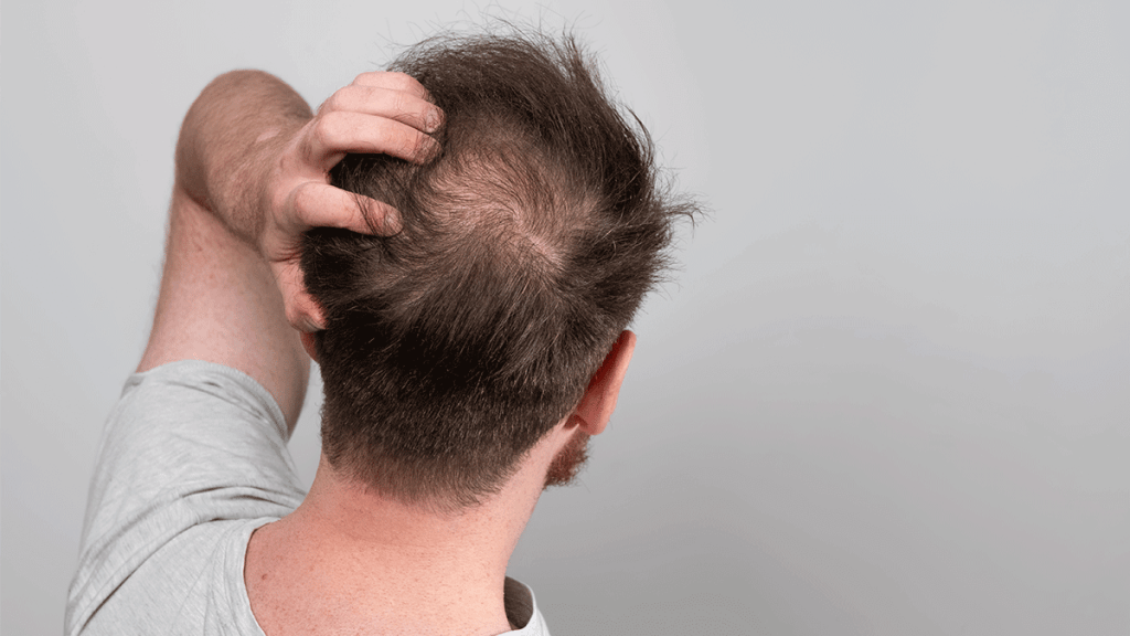 The Science of Hair Growth and Hair&nbsp;Loss